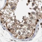 C17orf25 Antibody in Immunohistochemistry (IHC)