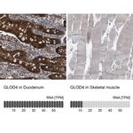 C17orf25 Antibody