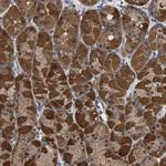 C17orf25 Antibody in Immunohistochemistry (IHC)