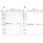 C17orf25 Antibody in Western Blot (WB)