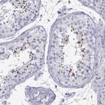 Actin-like 7A Antibody in Immunohistochemistry (IHC)