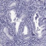 Actin-like 7A Antibody in Immunohistochemistry (IHC)