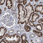 VPS13A Antibody in Immunohistochemistry (IHC)