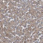 VPS13A Antibody in Immunohistochemistry (IHC)