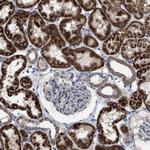 VPS13A Antibody in Immunohistochemistry (IHC)