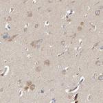 CCM2 Antibody in Immunohistochemistry (IHC)