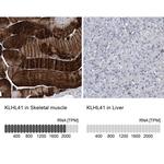 KLHL41 Antibody in Immunohistochemistry (IHC)