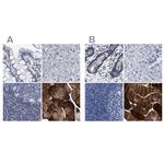 KLHL41 Antibody in Immunohistochemistry (IHC)