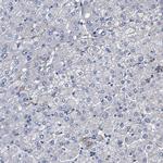 KLHL41 Antibody in Immunohistochemistry (IHC)