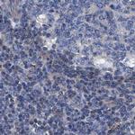 KLHL41 Antibody in Immunohistochemistry (IHC)