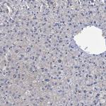 CROCC Antibody in Immunohistochemistry (IHC)