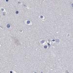 CROCC Antibody in Immunohistochemistry (IHC)