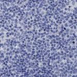 CROCC Antibody in Immunohistochemistry (IHC)