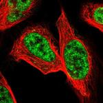 PRPF4 Antibody in Immunocytochemistry (ICC/IF)