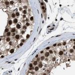 PRPF4 Antibody in Immunohistochemistry (IHC)