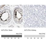 Actin-like 7B Antibody in Immunohistochemistry (IHC)