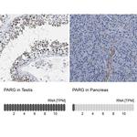 Parg Antibody in Immunohistochemistry (IHC)