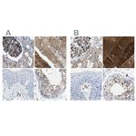 Dysferlin Antibody in Immunohistochemistry (IHC)