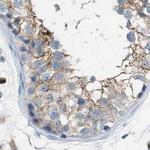 Dysferlin Antibody in Immunohistochemistry (IHC)