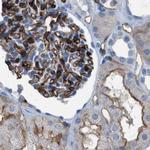 Dysferlin Antibody in Immunohistochemistry (IHC)