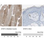 Dysferlin Antibody