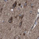 ECHS1 Antibody in Immunohistochemistry (IHC)