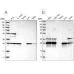 ECHS1 Antibody in Western Blot (WB)