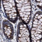 MECR Antibody in Immunohistochemistry (IHC)