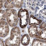 MECR Antibody in Immunohistochemistry (IHC)