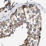 MECR Antibody in Immunohistochemistry (IHC)