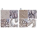 MECR Antibody in Immunohistochemistry (IHC)