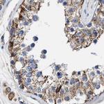 MECR Antibody in Immunohistochemistry (IHC)