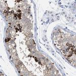 TACC3 Antibody in Immunohistochemistry (IHC)