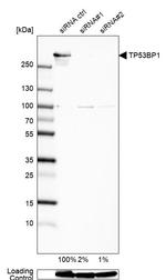 53BP1 Antibody