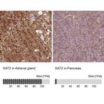 SAT2 Antibody in Immunohistochemistry (IHC)