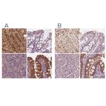 SAT2 Antibody in Immunohistochemistry (IHC)