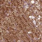 SAT2 Antibody in Immunohistochemistry (IHC)