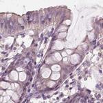 SAT2 Antibody in Immunohistochemistry (IHC)