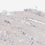 PFAS Antibody in Immunohistochemistry (IHC)