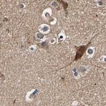 Axotrophin Antibody in Immunohistochemistry (IHC)