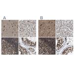 PRPF4 Antibody in Immunohistochemistry (IHC)