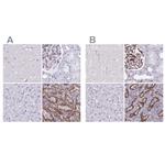 PITPNM3 Antibody in Immunohistochemistry (IHC)