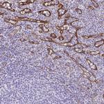 PITPNM3 Antibody in Immunohistochemistry (IHC)