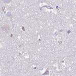 PITPNM3 Antibody in Immunohistochemistry (IHC)