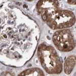 PECR Antibody in Immunohistochemistry (IHC)