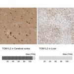 TOM1L2 Antibody in Immunohistochemistry (IHC)