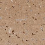 TOM1L2 Antibody in Immunohistochemistry (IHC)