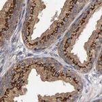 CANT1 Antibody in Immunohistochemistry (IHC)