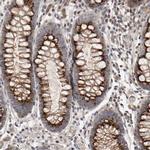 CANT1 Antibody in Immunohistochemistry (IHC)