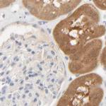 HRSP12 Antibody in Immunohistochemistry (IHC)